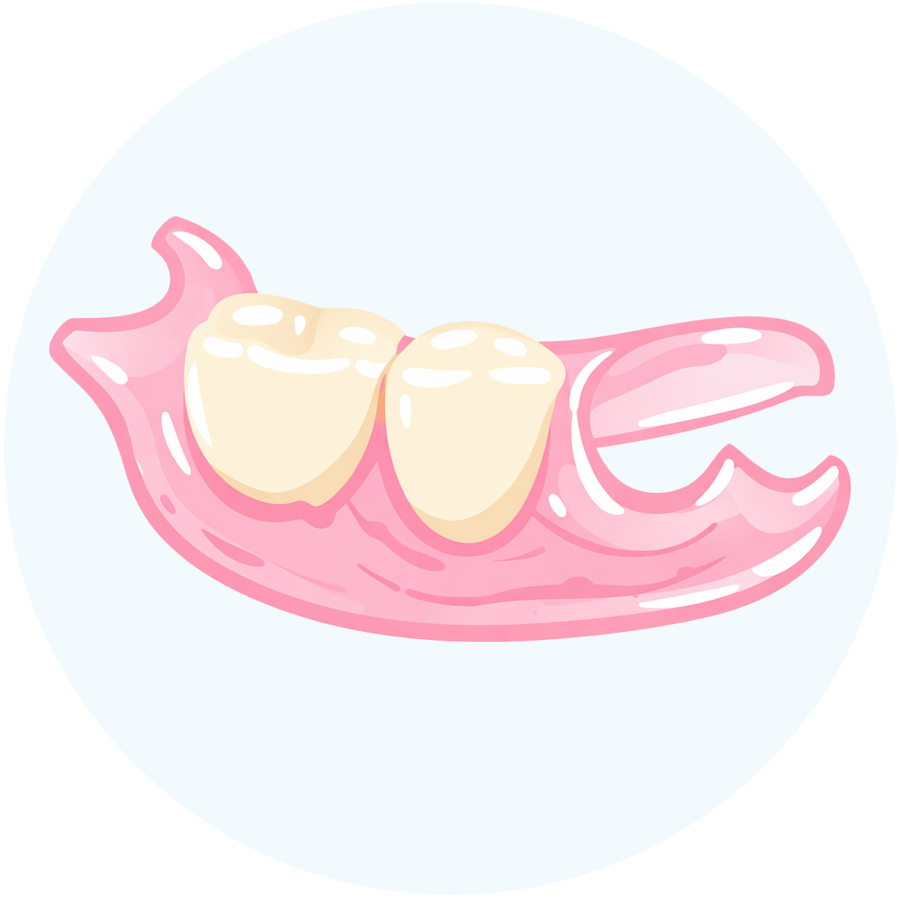 ノンクラスプデンチャー